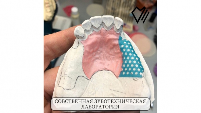 Собственная зуботехническая лаборатория — качество и скорость на высоте!