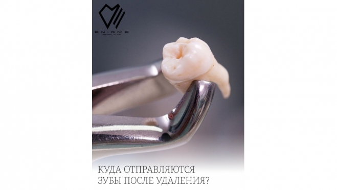 Куда отправляются зубы после удаления?