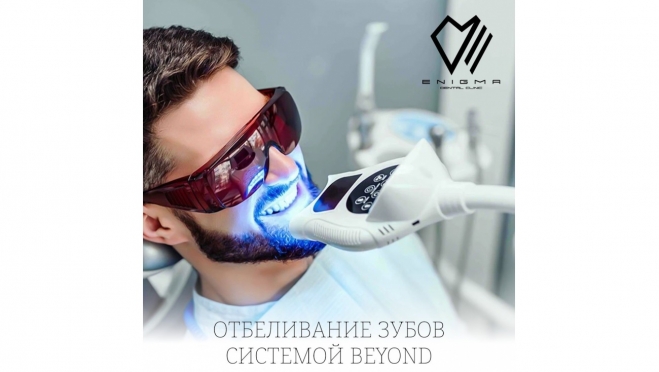 Отбеливание зубов системой Beyond в стоматологической клинике «Энигма» — безопасно, комфортно и эффективно!